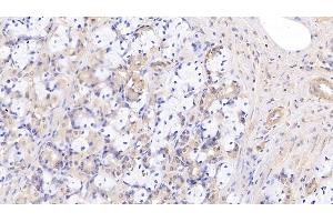 Immunohistochemistry (IHC) image for anti-Collagen, Type VIII, alpha 1 (COL8A1) (AA 575-743) antibody (ABIN7426484)