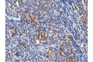 Image no. 1 for anti-rho GTPase Activating Protein 25 (ARHGAP25) antibody (ABIN1496701) (ARHGAP25 抗体)