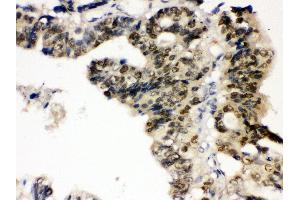 Immunohistochemistry (IHC) image for anti-Protein tyrosine Phosphatase, Non-Receptor Type 2 (PTPN2) (AA 1-330) antibody (ABIN3043447)