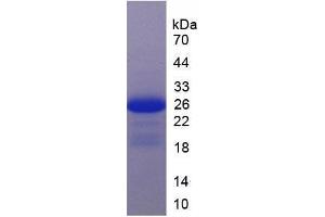Figure. (IL17RC Protein (AA 257-477) (His tag))