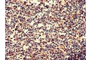 Immunohistochemistry analysis of human tonsil tissue using ABIN7156038 at dilution of 1:100 (IgD 抗体  (AA 1-240))