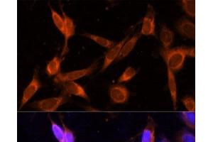 Immunofluorescence analysis of NIH-3T3 cells using VMP1 Polyclonal Antibody at dilution of 1:100 (40x lens). (VMP1 抗体)