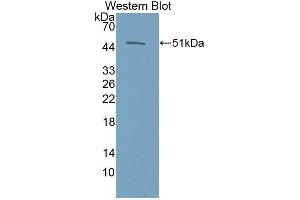 Western Blotting (WB) image for anti-Erythropoietin (EPO) antibody (Biotin) (ABIN1172018) (EPO 抗体  (Biotin))