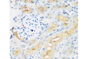Immunohistochemistry of paraffin-embedded Rat kidney using PROCR Polyclonal Antibody at dilution of 1:200 (40x lens). (PROCR 抗体)