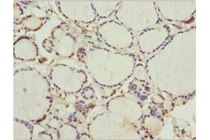 Immunohistochemistry of paraffin-embedded human thyroid tissue using ABIN7175755 at dilution of 1:100 (WDR47 抗体  (AA 350-600))