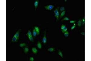 Immunofluorescent analysis of Hela cells using ABIN7151864 at dilution of 1:100 and Alexa Fluor 488-congugated AffiniPure Goat Anti-Rabbit IgG(H+L) (EPH Receptor B3 抗体  (AA 261-390))