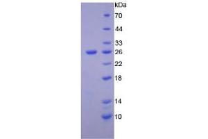 SDS-PAGE analysis of Human PTK7 Protein. (PTK7 蛋白)