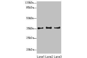 Western blot All lanes: NUP35 antibody at 12 μg/mL Lane 1: Jurkat whole cell lysate Lane 2: A431 whole cell lysate Lane 3: HepG2 whole cell lysate Secondary Goat polyclonal to rabbit IgG at 1/10000 dilution Predicted band size: 35, 34, 22 kDa Observed band size: 35 kDa (NUP35 抗体  (AA 6-305))