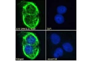 ABIN238594 Immunofluorescence analysis of paraformaldehyde fixed A431 cells, permeabilized with 0. (EPB41L2 抗体  (Internal Region))