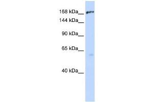 ABCC1 antibody used at 1 ug/ml to detect target protein. (ABCC1 抗体)