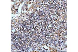 IHC analysis of IL22 using anti-IL22 antibody (ABIN5518929). (IL-22 抗体  (AA 34-179))