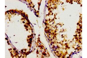 Immunohistochemistry of paraffin-embedded human testis tissue using ABIN7149710 at dilution of 1:100