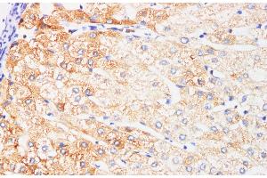 Immunohistochemistry of paraffin-embedded Human liver using IFNAR1 Polyclonl Antibody at dilution of 1:200. (IFNAR1 抗体)