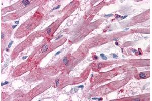 Human Heart: Formalin-Fixed, Paraffin-Embedded (FFPE) (BAG3 抗体  (AA 563-575))