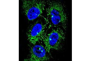 Immunofluorescence (IF) image for anti-Alcohol Dehydrogenase 7 (Class IV), mu Or sigma Polypeptide (ADH7) (AA 318-346), (C-Term) antibody (ABIN653658)