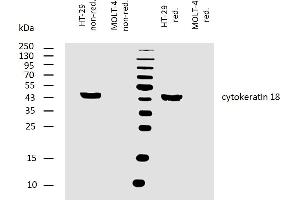 Western blotting analysis of human cytokeratin 18 using mouse monoclonal antibody DA-7 on lysates of HT-29 cell line and MOLT-4 cell line (cytokeratin non-expressing cell line, negative control) under non-reducing and reducing conditions. (Cytokeratin 18 抗体)