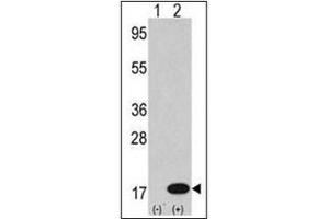 Western Blotting (WB) image for anti-Microtubule-Associated Protein 1 Light Chain 3 beta (MAP1LC3B) (AA 1-30), (N-Term) antibody (ABIN5555711)
