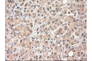 Image no. 4 for anti-Myc Proto-Oncogene protein (MYC) antibody (ABIN1497011) (c-MYC 抗体)