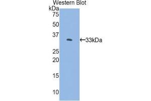 Western blot analysis of the recombinant protein. (FKBP10 抗体  (AA 158-440))
