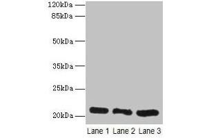 Western blot All lanes: GM2A antibody at 10 μg/mL Lane 1: Rat liver tissue Lane 2: Mouse stomach tissue Lane 3: Mouse small intestine tissue Secondary Goat polyclonal to rabbit IgG at 1/10000 dilution Predicted band size: 21 kDa Observed band size: 21 kDa (GM2A 抗体  (AA 32-193))