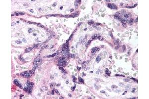 Image no. 1 for anti-Epidermal Growth Factor Receptor (EGFR) (AA 1189-1199), (pTyr1197) antibody (ABIN401341) (EGFR 抗体  (pTyr1197))