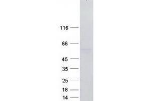 RBMS3 Protein (Transcript Variant 2) (Myc-DYKDDDDK Tag)