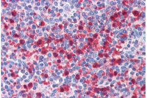 Human Spleen: Formalin-Fixed, Paraffin-Embedded (FFPE) (Polybromo 1 抗体  (AA 1511-1560))