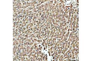 IHC analysis of KAT1/HAT1 using anti-KAT1/HAT1 antibody (ABIN7603224).