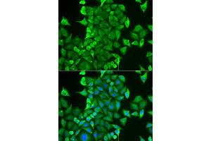 Immunofluorescence analysis of HeLa cells using CARS antibody (ABIN6129260, ABIN6137946, ABIN6137948 and ABIN6222203). (CARS 抗体  (AA 469-748))
