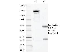 SDS-PAGE Analysis Purified p63 Mouse Monoclonal Antibody (TP63/2427). (p63 抗体)