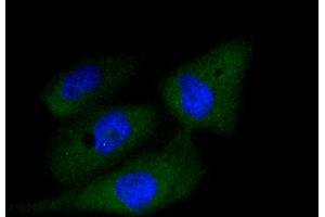 Immunofluorescence analysis of PC-3M cells using CASP3 antibody (ABIN4903137). (Caspase 3 抗体)