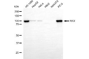 Western blotting analysis using RIGI antibody (ABIN7800966). (Recombinant RNA Sensor RIG-I 抗体)