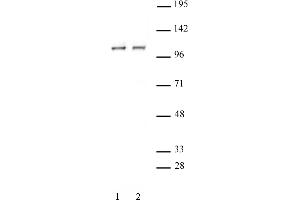 STAT2 antibody (pAb) tested by Western blot. (STAT2 抗体  (C-Term))
