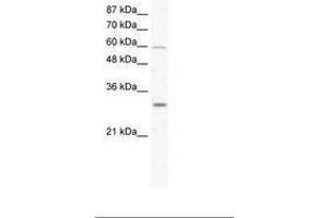 Image no. 1 for anti-DEAD (Asp-Glu-Ala-Asp) Box Polypeptide 31 (DDX31) (AA 140-189) antibody (ABIN203216) (DDX31 抗体  (AA 140-189))