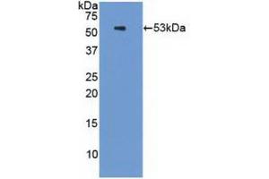 Western blot analysis of recombinant Human PSMC3. (PSMC3 抗体  (AA 2-439))