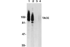 Image no. 1 for anti-ADAM Metallopeptidase Domain 17 (ADAM17) (C-Term) antibody (ABIN201454) (ADAM17 抗体  (C-Term))