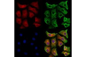 ABIN6260031 and ABIN6273193 staining Hela cells by IF/ICC.
