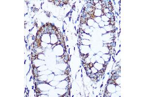 Immunohistochemistry of paraffin-embedded human tonsil using PLK1 Rabbit mAb (ABIN7269436) at dilution of 1:100 (40x lens). (PLK1 抗体)