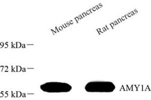 Western blot analysis of AMY1A (ABIN7075503) at dilution of 1: 500 (Salivary Amylase alpha 抗体)
