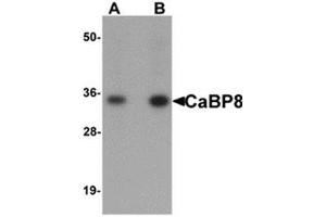 Western blot analysis of CaBP8 in 3T3 cell lysate with CaBP8 antibody at (A) 1 and (B) 2 μg/ml. (Calneuron 1 抗体  (N-Term))
