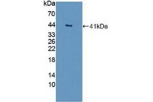 Detection of Recombinant GNb2, Human using Polyclonal Antibody to G Protein Beta 2 (GNb2) (GNB2 抗体  (AA 2-340))