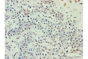Immunohistochemistry (IHC) image for anti-ATP-Binding Cassette, Sub-Family E (OABP), Member 1 (ABCE1) (AA 320-599) antibody (ABIN7144924)