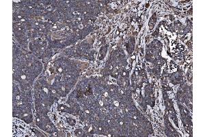 IHC analysis of NSF using anti-NSF antibody (ABIN7601630). (NSF 抗体  (AA 4-636))