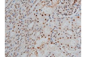 ABIN6268991 at 1/200 staining human kidney tissue sections by IHC-P. (PPP1R12A 抗体  (pThr853))