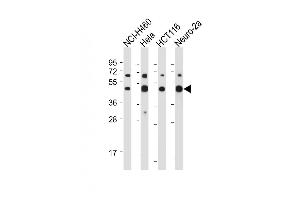 Western Blotting (WB) image for anti-Solute Carrier Family 16 (Monocarboxylic Acid Transporters), Member 3 (SLC16A3) (AA 433-462), (C-Term) antibody (ABIN656331)