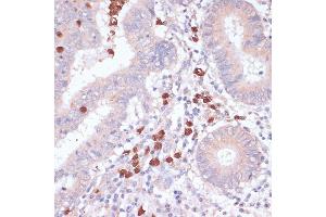 Immunohistochemistry of paraffin-embedded human colon using CD82 antibody (ABIN6131855, ABIN6138233, ABIN6138234 and ABIN6218884) at dilution of 1:100 (40x lens). (CD82 抗体  (C-Term))