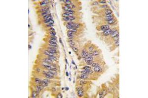 Image no. 1 for anti-Frequently Rearranged in Advanced T-Cell Lymphomas (FRAT1) (C-Term) antibody (ABIN356924) (FRAT1 抗体  (C-Term))