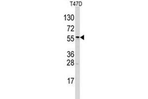 Image no. 1 for anti-Aldehyde Dehydrogenase 6 Family, Member A1 (ALDH6A1) (N-Term) antibody (ABIN356978) (ALDH6A1 抗体  (N-Term))