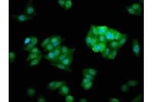 Immunofluorescence staining of HepG2 cells with ABIN7147529 at 1:266, counter-stained with DAPI. (CHMP5 抗体  (AA 1-219))