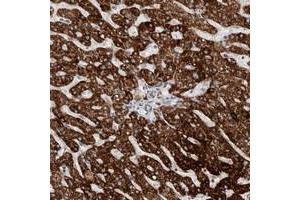 Immunohistochemical staining of human liver with C17orf99 polyclonal antibody  shows strong cytoplasmic positivity in hepatocytes at 1:50-1:200 dilution. (C17ORF99 抗体)